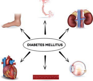 What is Diabetes Mellitus?