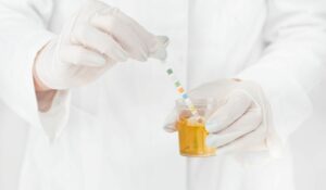 Ketones in Urine Treatment