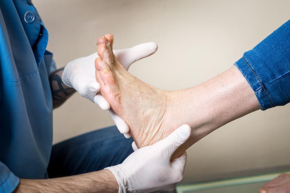 Managing Diabetic Foot: How To Prevent the Condition?