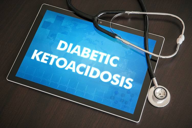 Understanding Diabetic Ketoacidosis: Treatment and Management Strategies