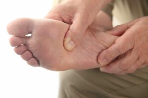What Is The First Rule Of Diabetic Foot Care?