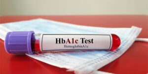 Understanding HbA1c