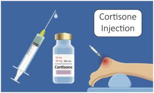 What are Cortisone Shots?