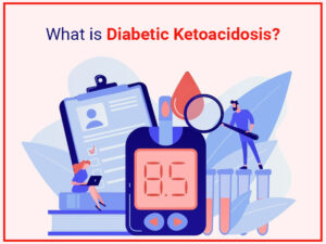 What is Diabetic Ketoacidosis Coma?