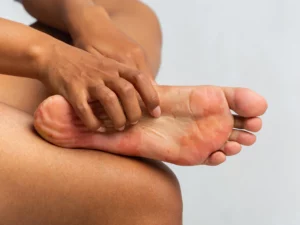 Why Do Diabetics Feet Itch So Much?