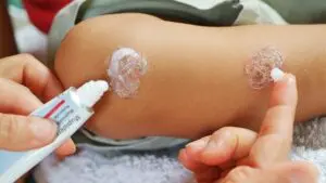 Topical Antibiotics