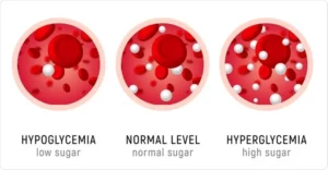 Managing Hyperglycemia: Effective Home Treatments and Tips