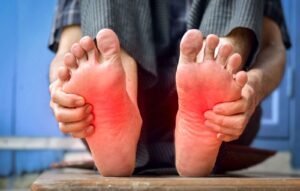 Does Diabetes Cause Burning Feet?