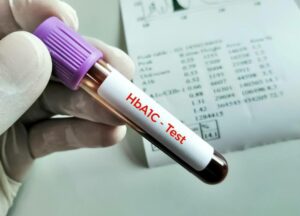 High HbA1c Levels treatment