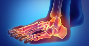 What Are The Medical Diabetic Arthropathy Treatments?